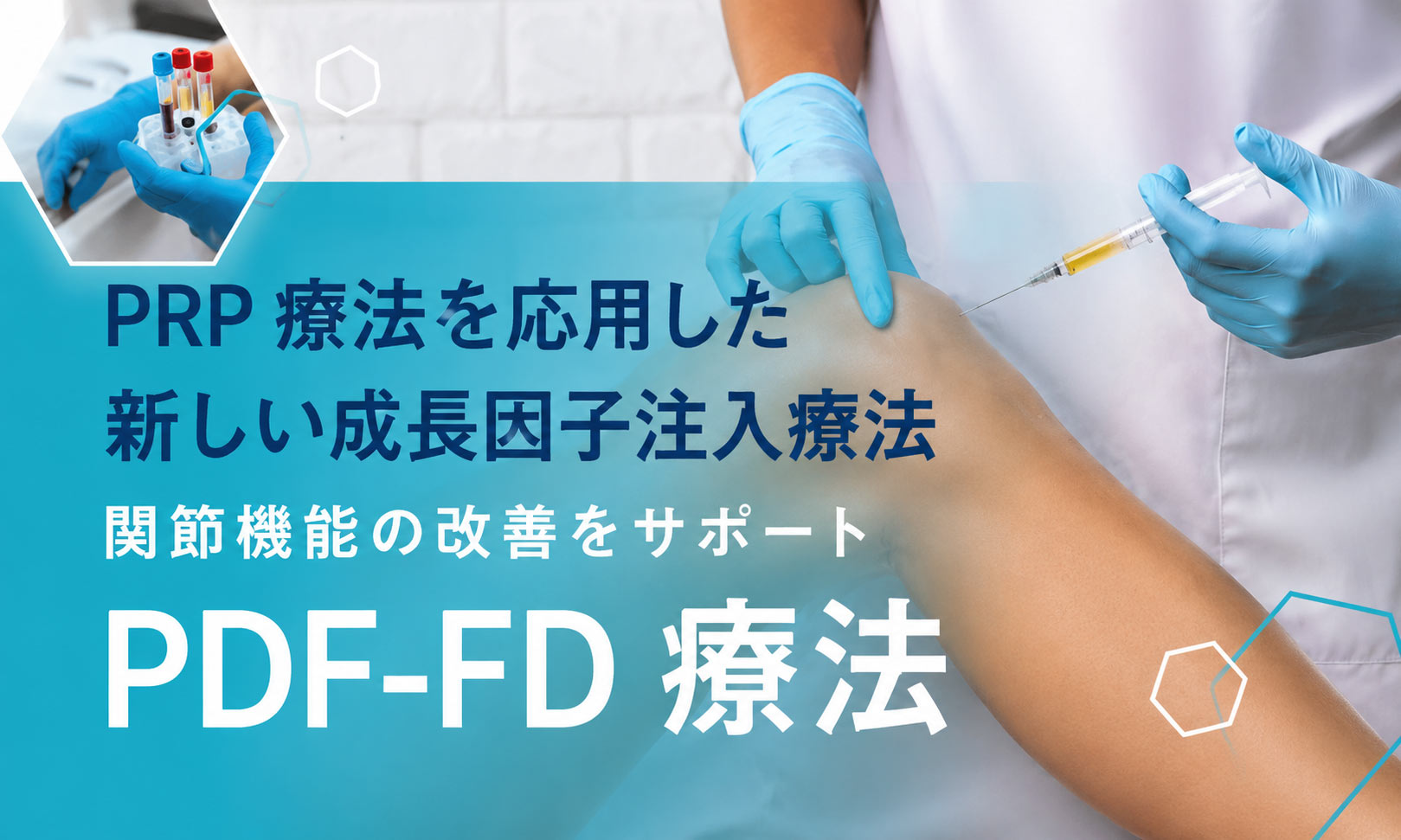 PRP療法を応用した新しい成長因子注入療法